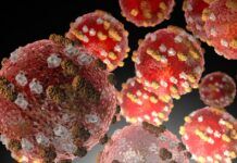 NMHealth Reports Four New Cases of Measles in Southern New Mexico Detention Centers